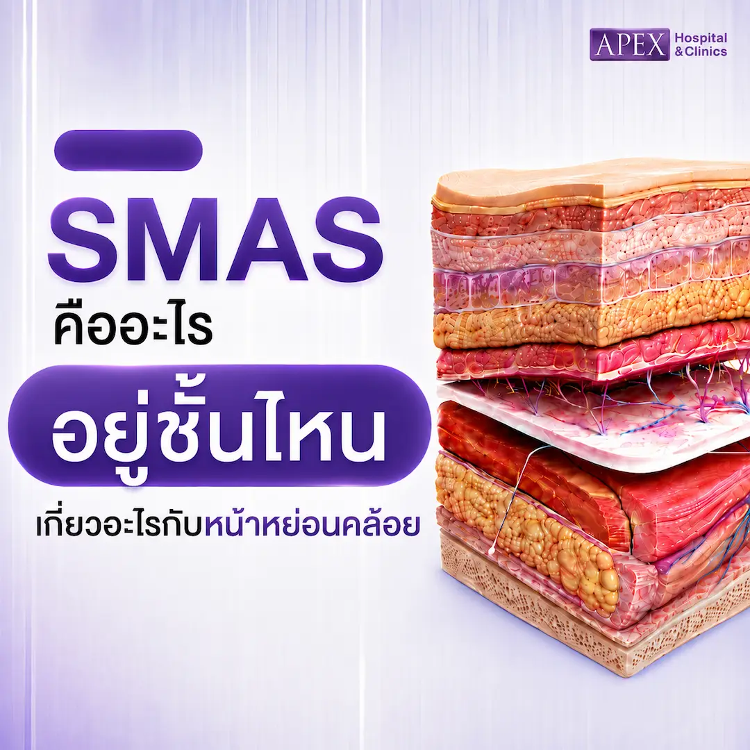 SMAS คืออะไร อยู่ชั้นไหน