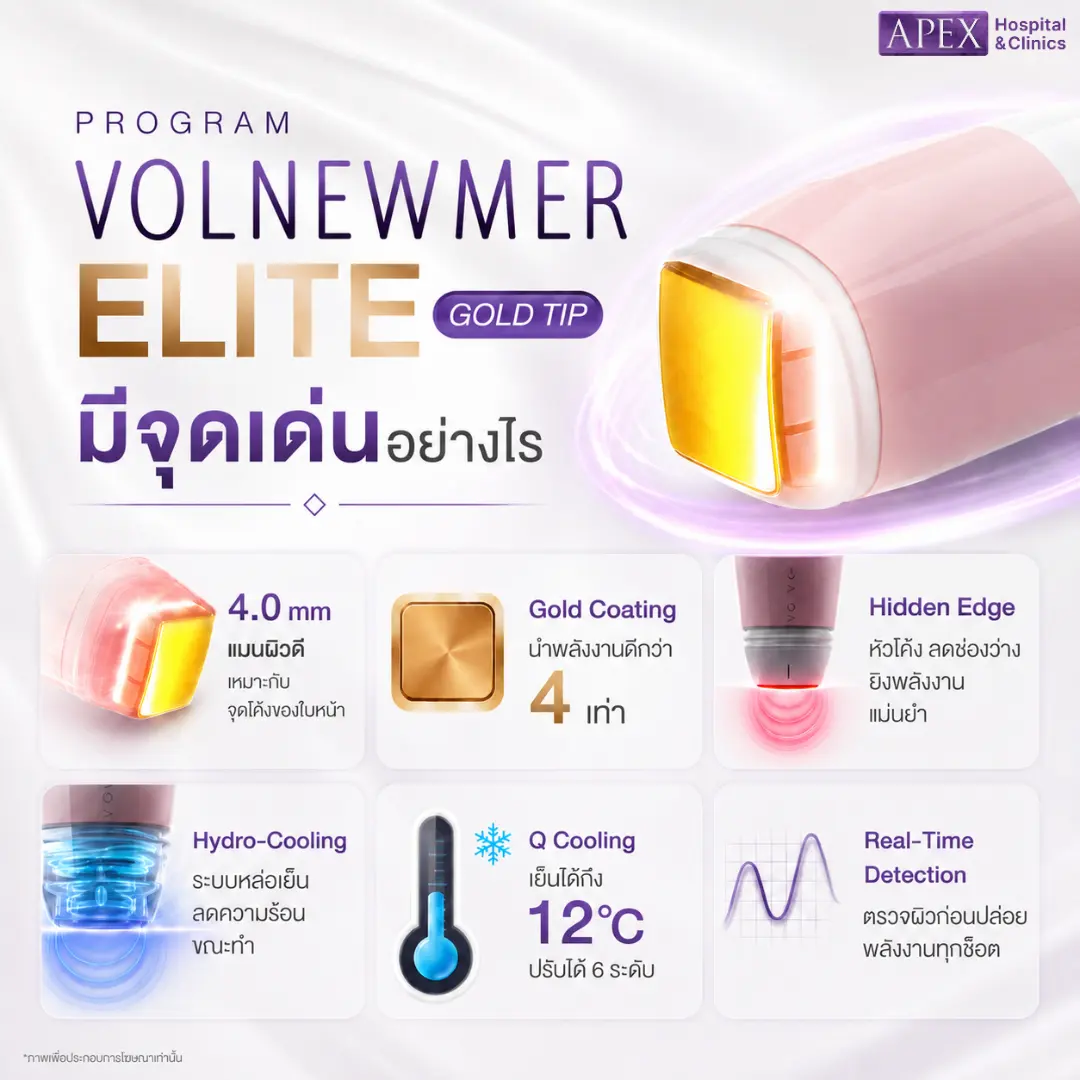 Volnewmer Elite Gold Tip ดีอย่างไร