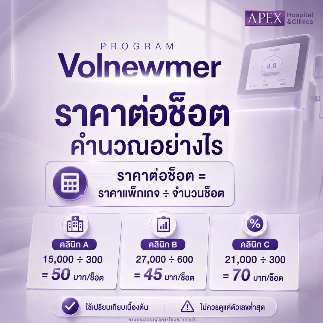 Volnewmer ราคาต่อช็อตคำนวณอย่างไร