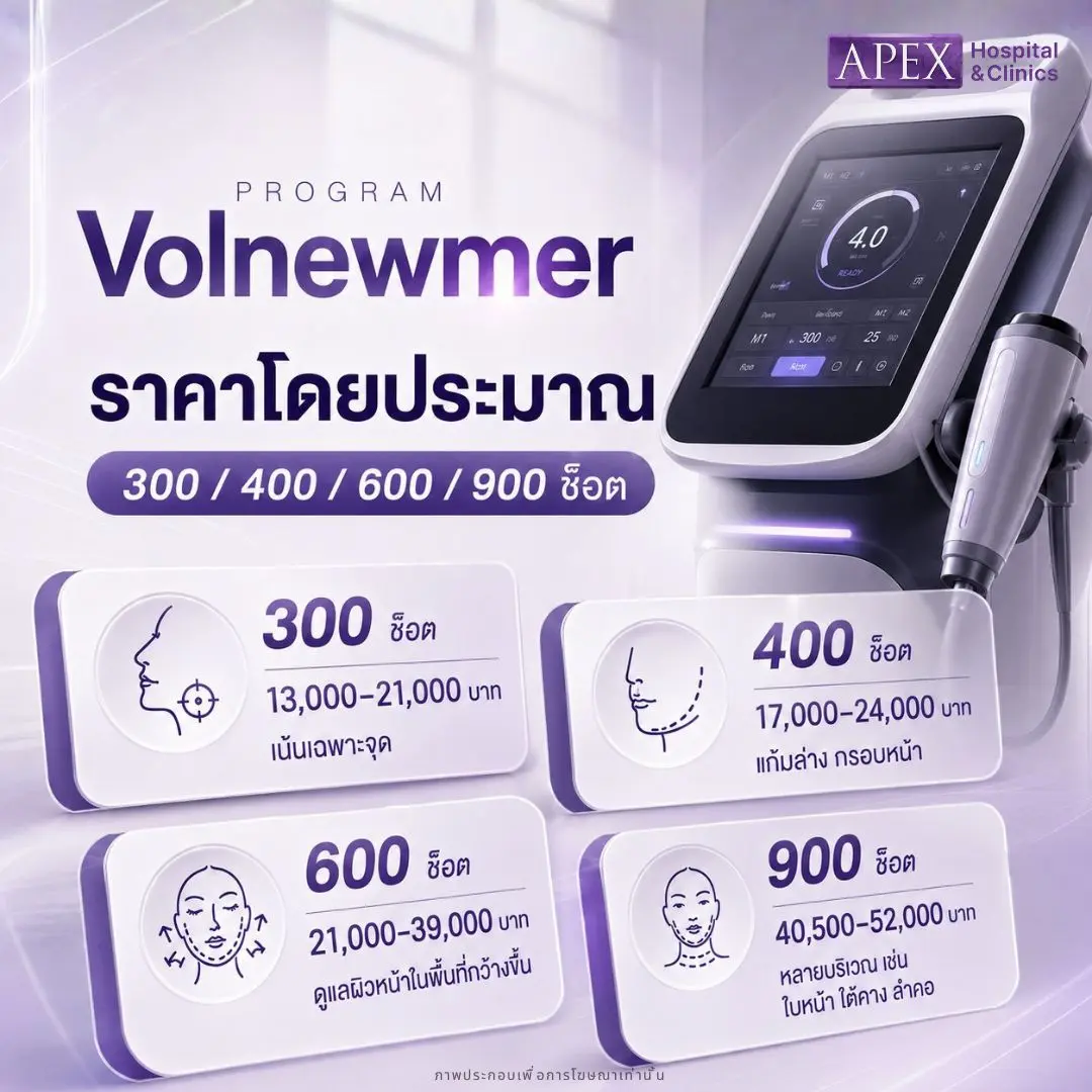 Volnewmer ราคาเท่าไหร่ โดยประมาณ