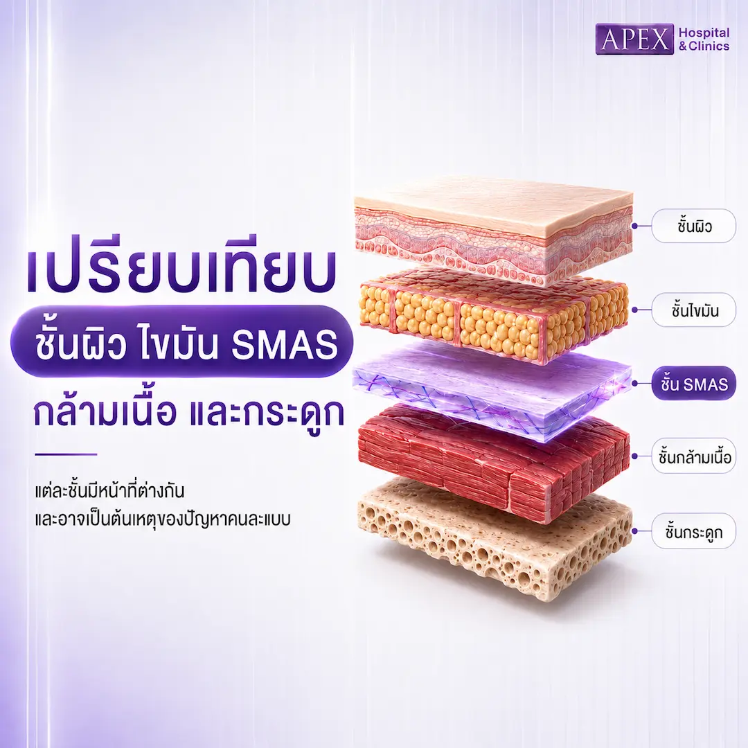 เปรียบเทียบชั้นผิว ไขมัน SMAS กล้ามเนื้อ และกระดูก