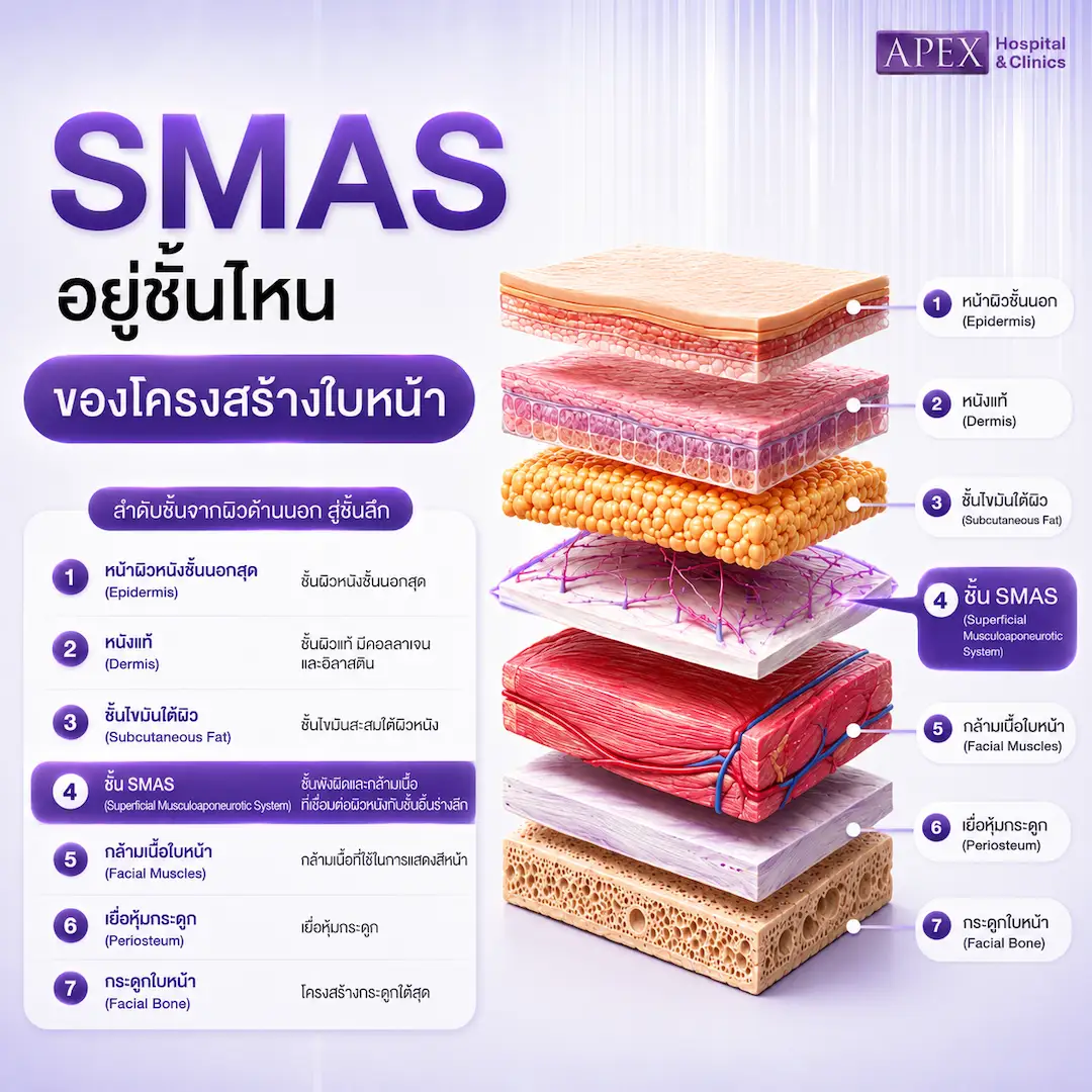 SMAS อยู่ชั้นไหนของโครงสร้างใบหน้า