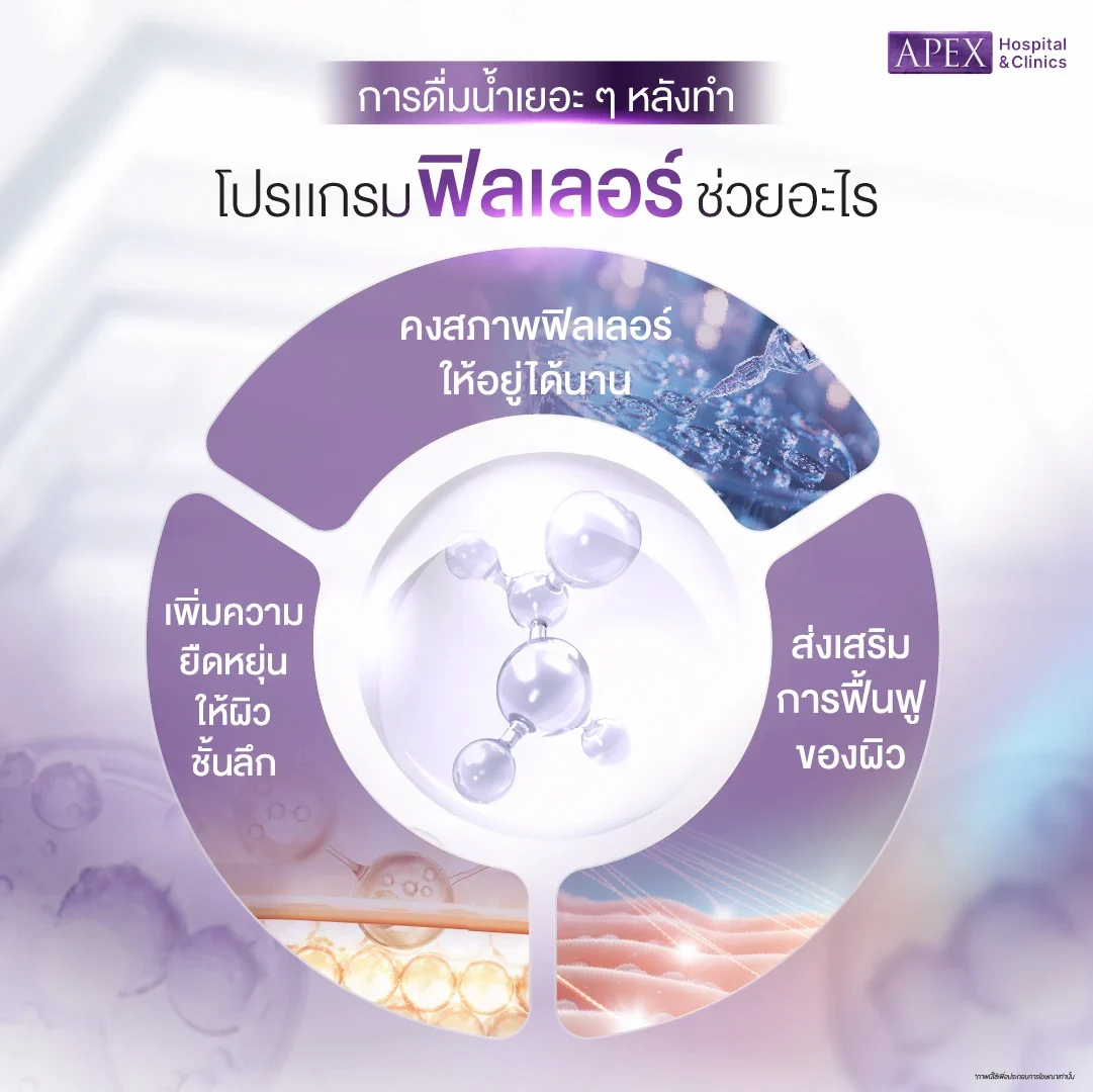 การดื่มน้ำเยอะ ๆ หลังฉีดฟิลเลอร์ ช่วยอะไร