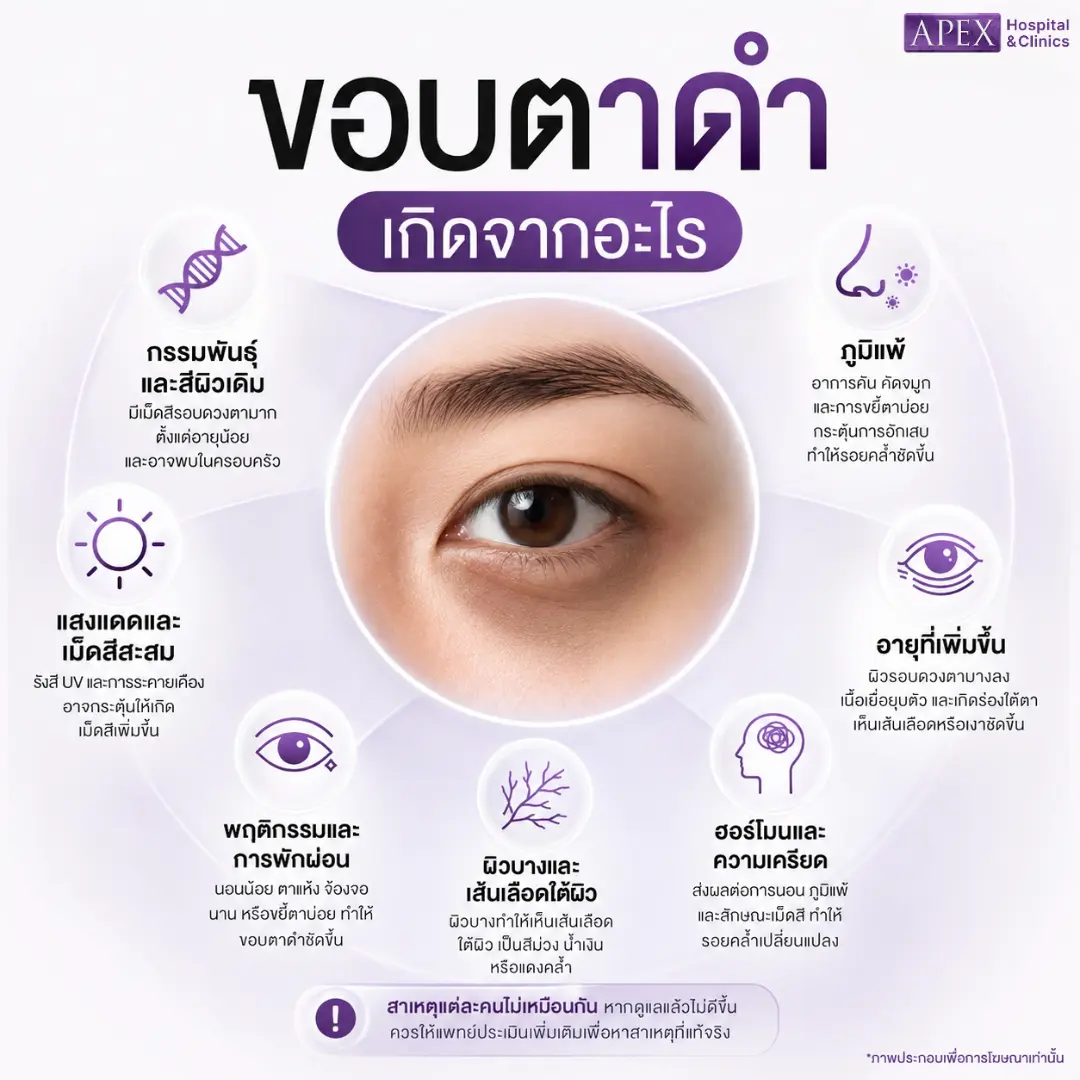 ขอบตาดำเกิดจากอะไร