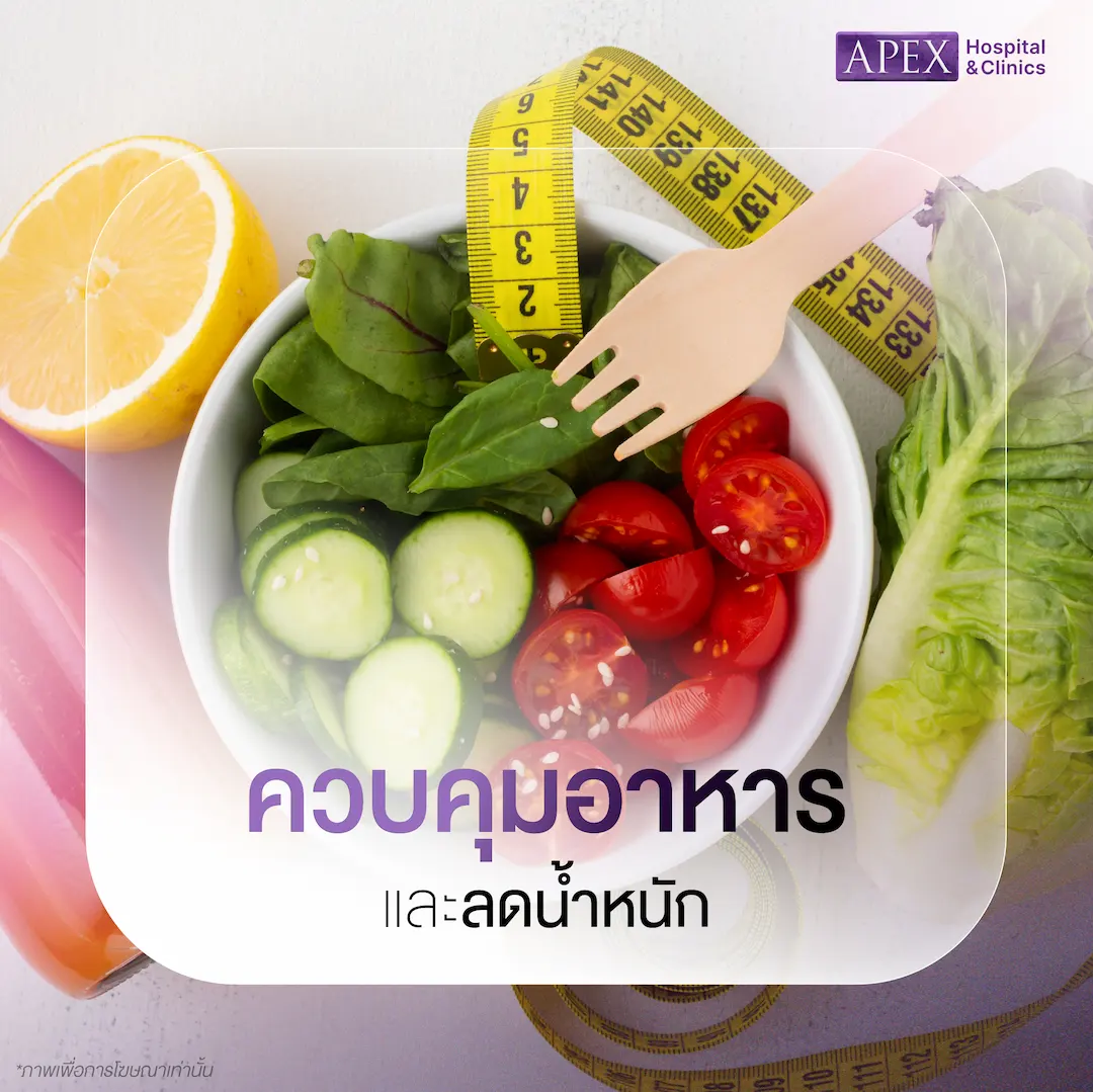 ควบคุมอาหารและลดน้ำหนัก