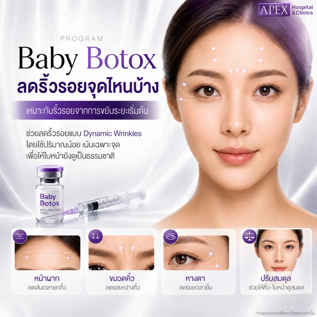 ฉีด Baby Botox ช่วยลดริ้วรอยจุดไหนบ้าง
