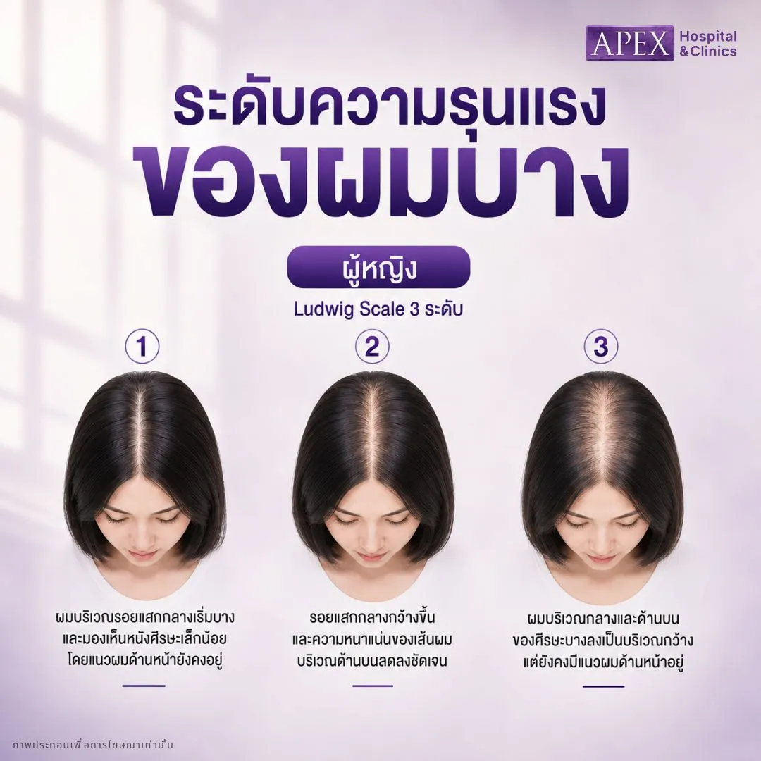 ผมร่วง ผู้หญิง