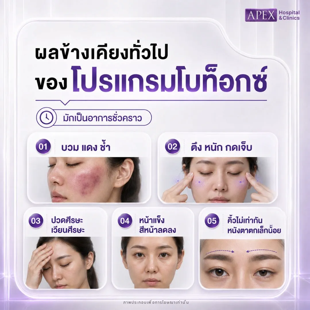 ผลข้างเคียงโบท็อกทั่วไปที่พบได้บ่อย
