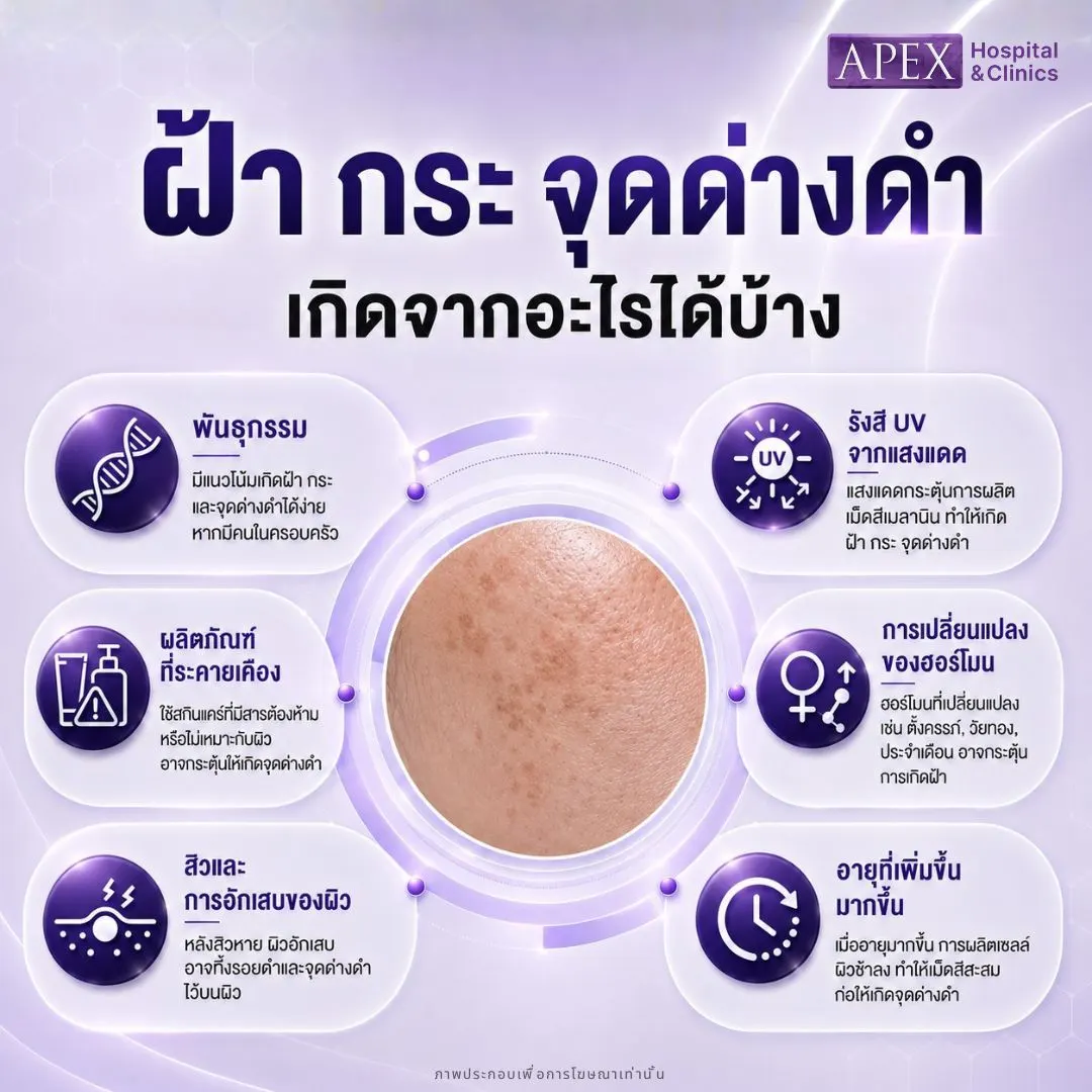 ฝ้า กระ จุดด่างดำ เกิดจากอะไรได้บ้าง