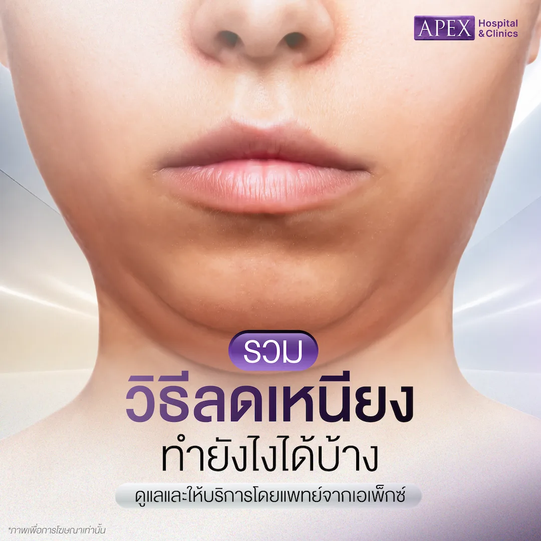 รวมวิธีลดเหนียง ทำยังไงได้บ้าง