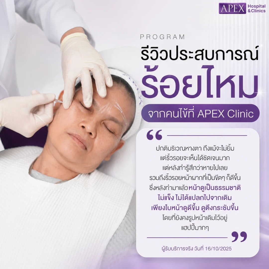 รีวิวร้อยไหม จากคนไข้ที่ APEX Clinic
