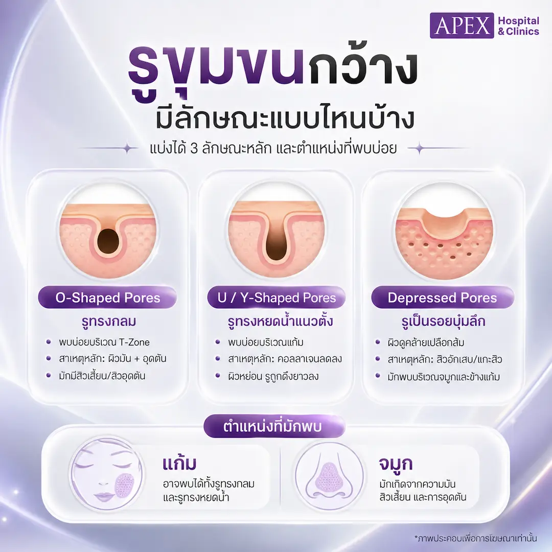 รูขุมขนกว้าง มีลักษณะแบบไหนบ้าง