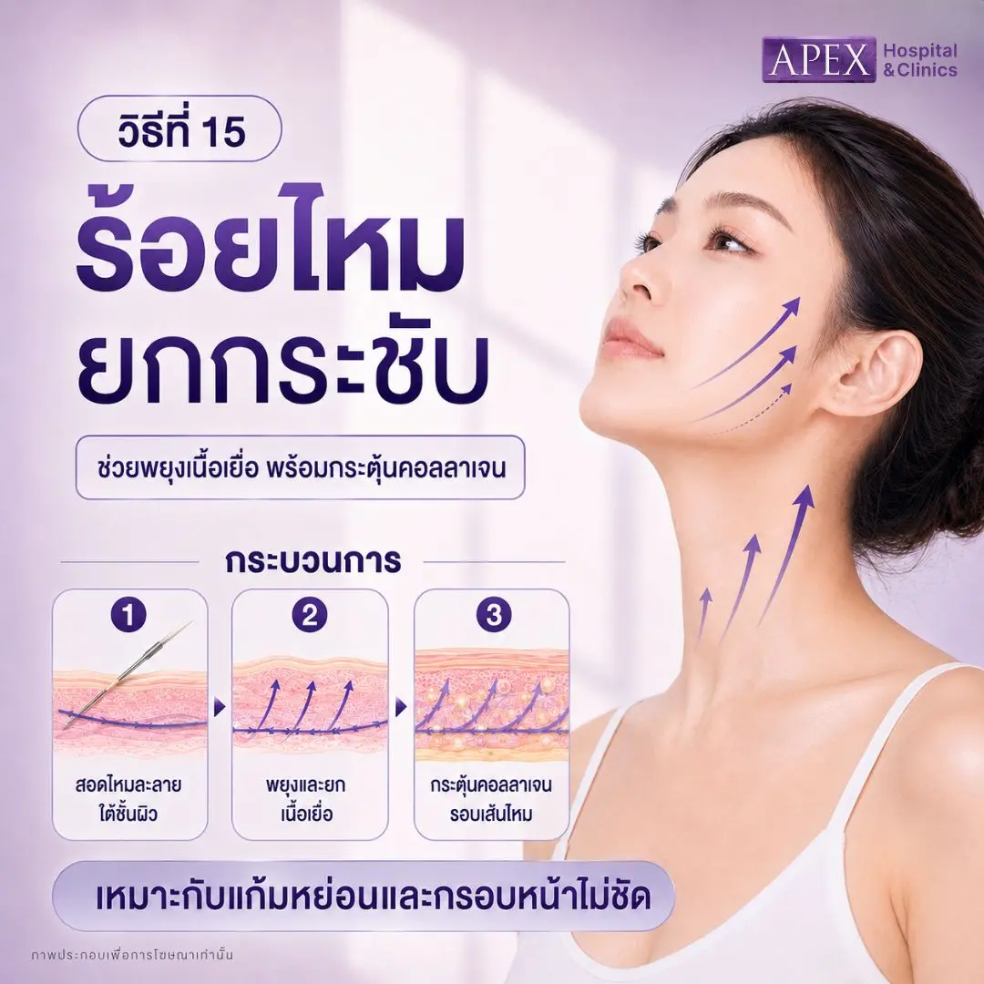 ร้อยไหมยกกระชับ