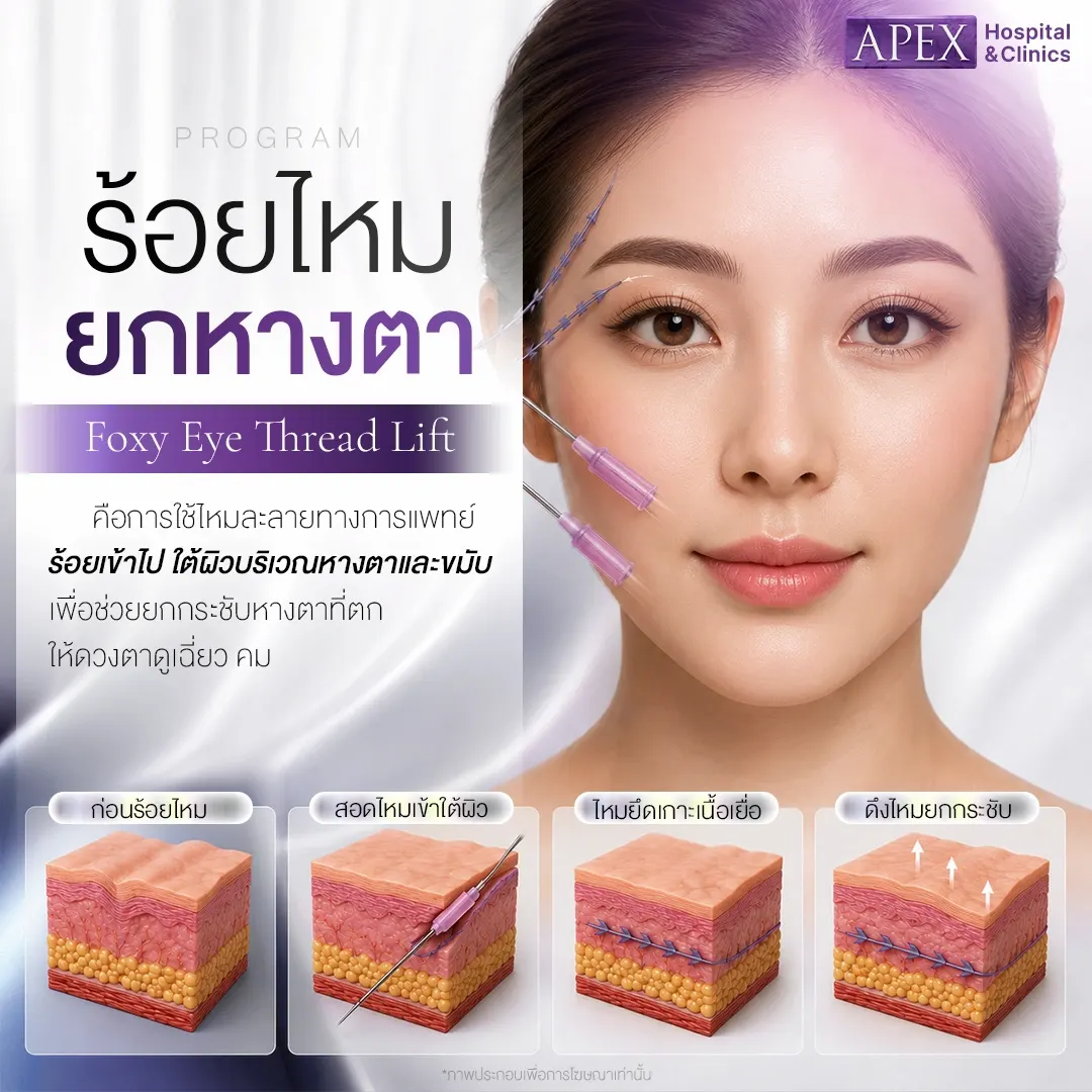 ร้อยไหมยกหางตา ทำงานอย่างไร