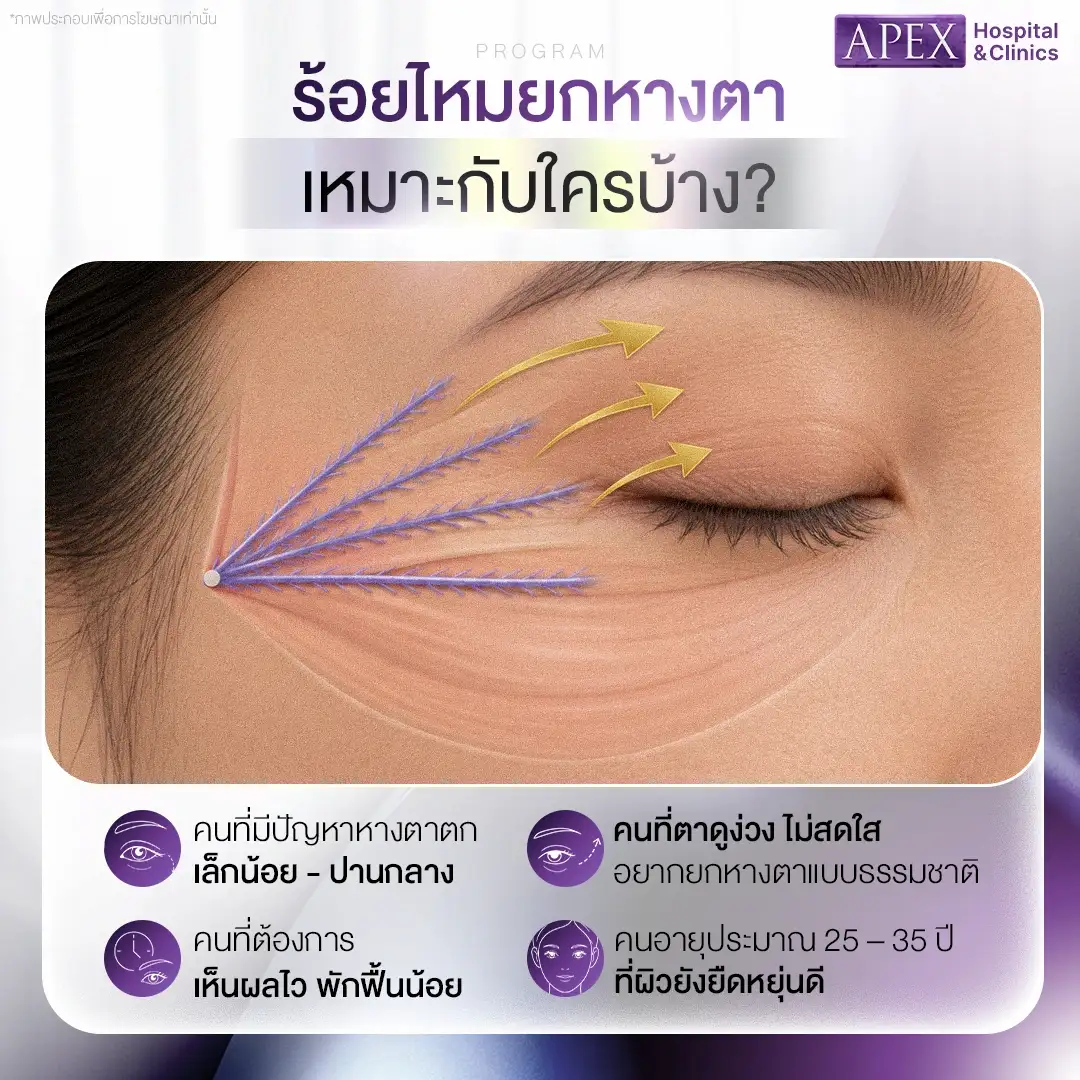 ร้อยไหมยกหางตา เหมาะกับใคร