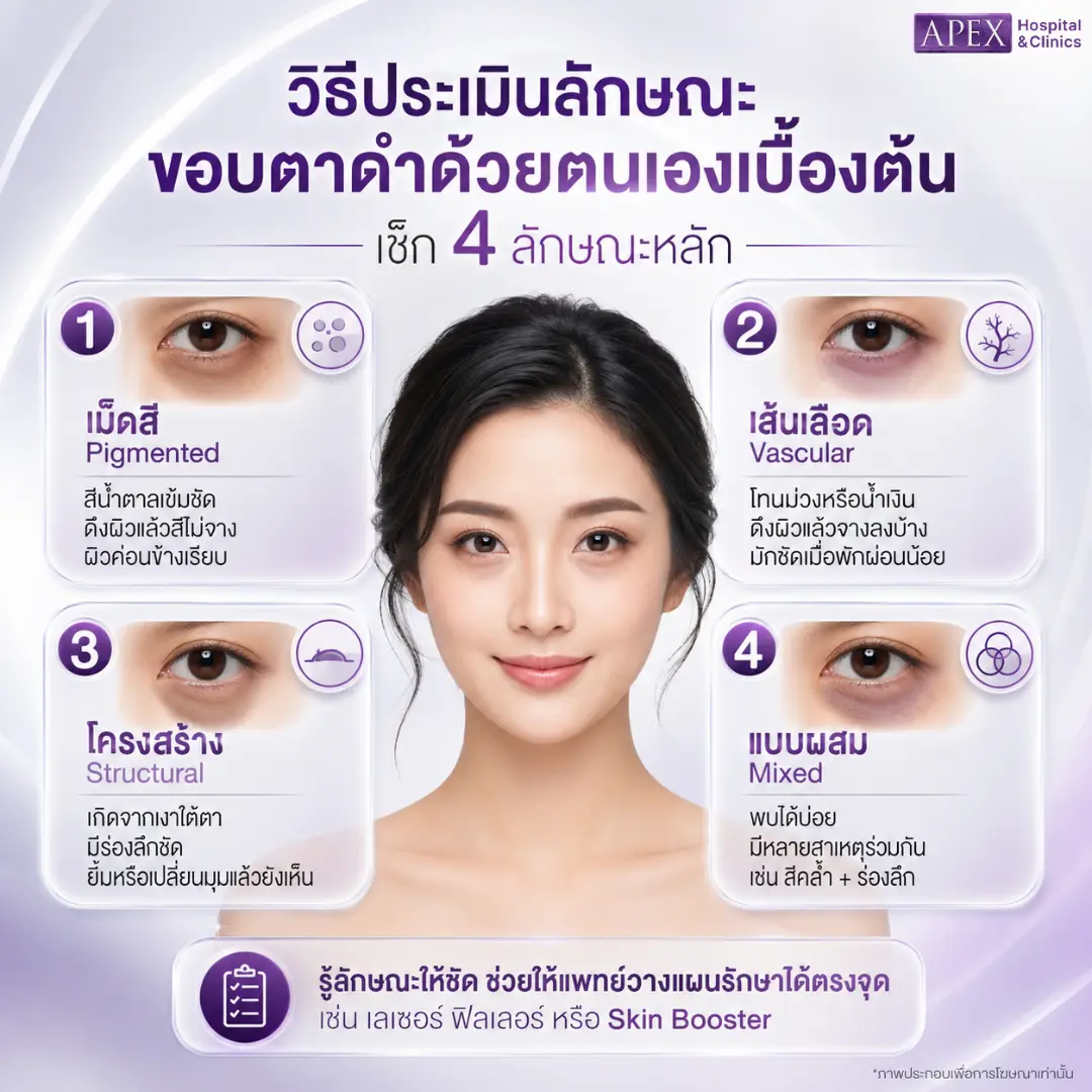 ลักษณะคนขอบตาดำ วิธีประเมินด้วยตนเอง