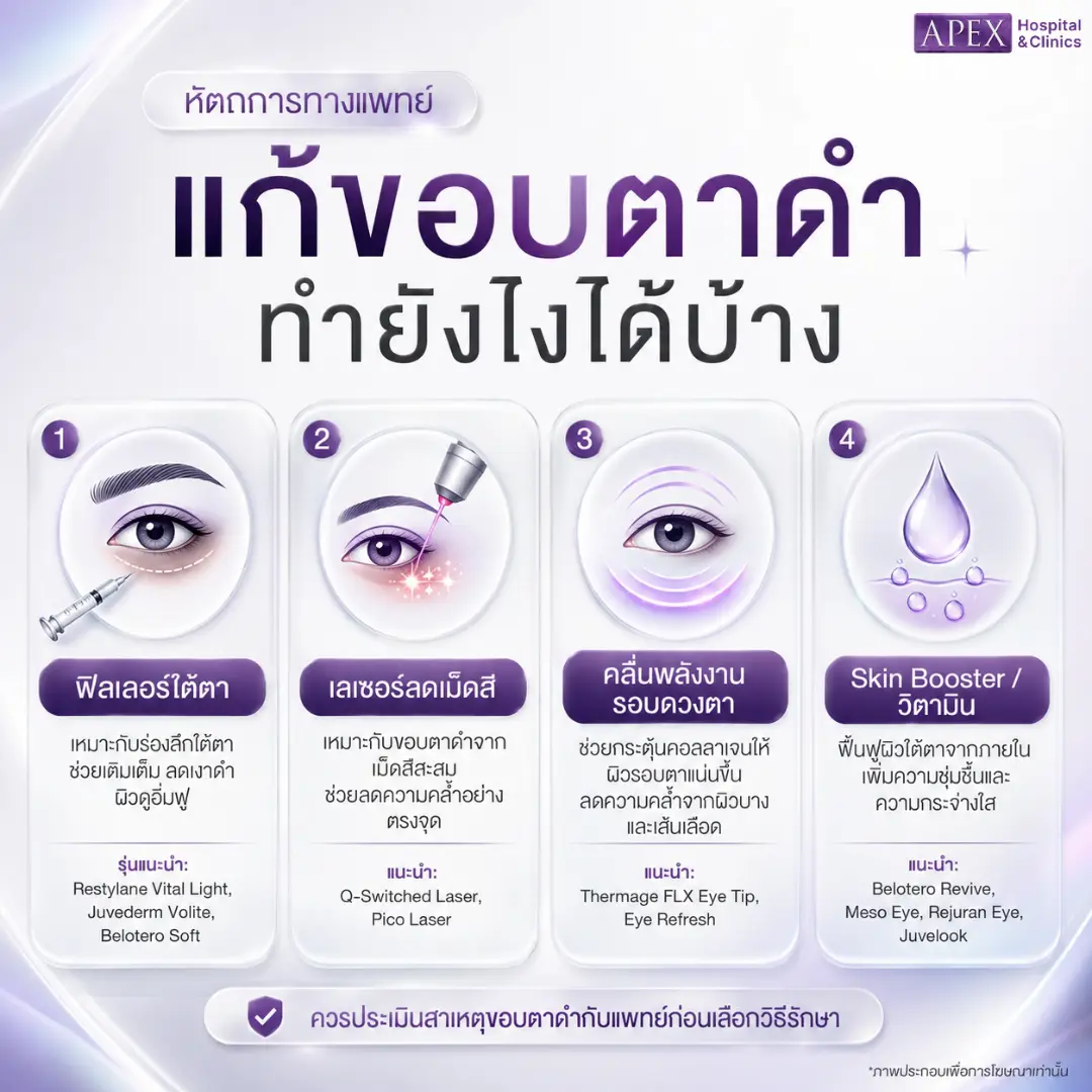 วิธีทำให้ขอบตาหายดำ ด้วยหัตถการทางแพทย์