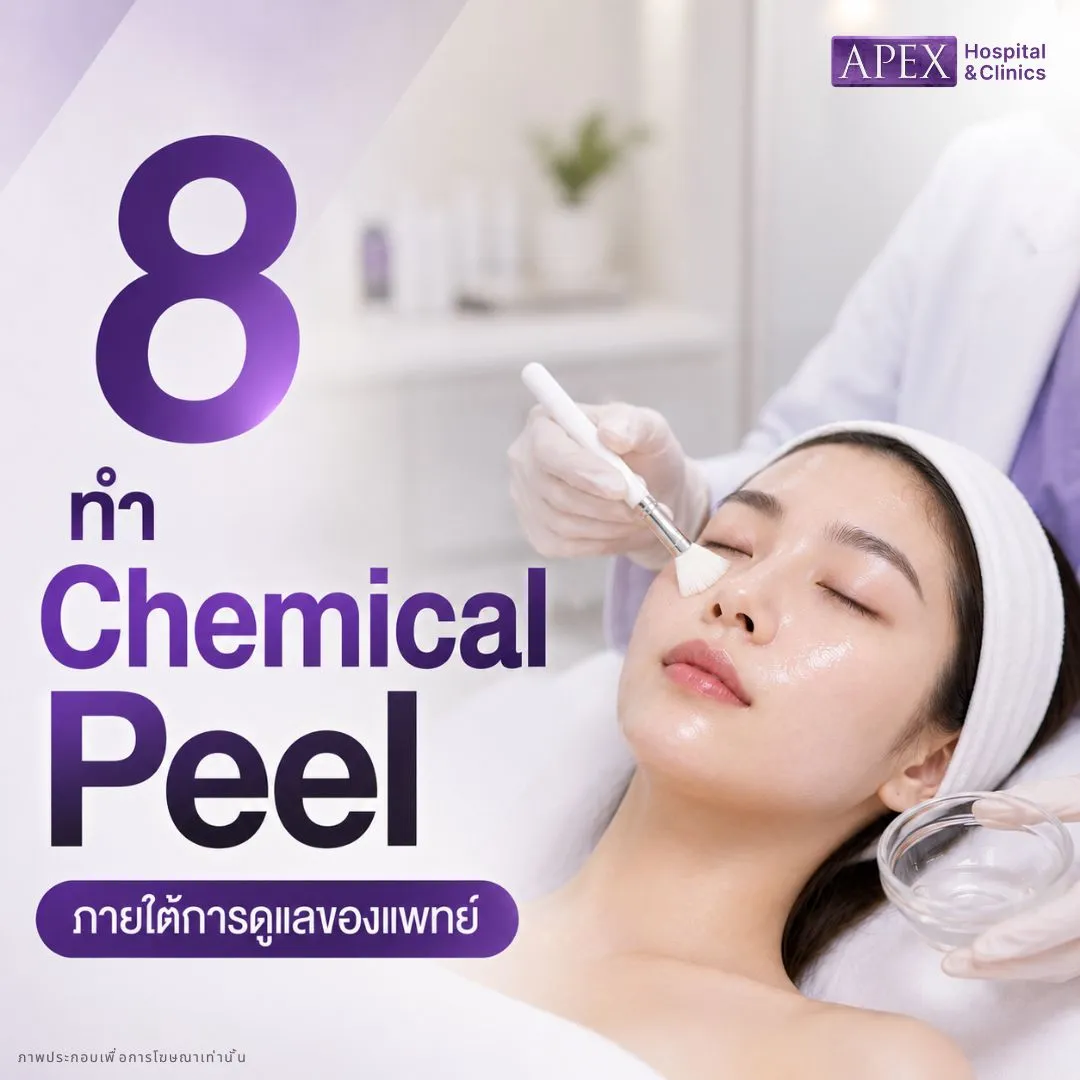 วิธีรักษาฝ้า ทำ Chemical Peel