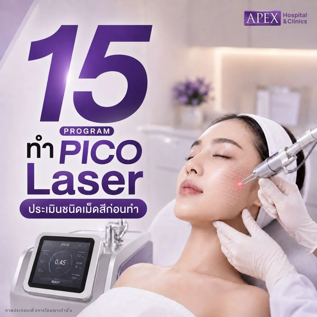 วิธีรักษาฝ้า ทำ pico