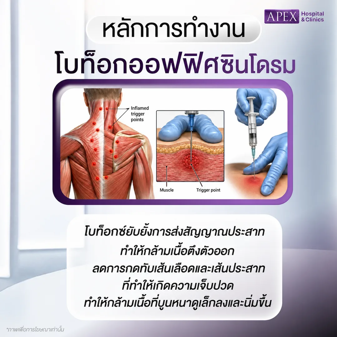 โบท็อกออฟฟิศซินโดรม ช่วยลดปวดได้จริงไหม
