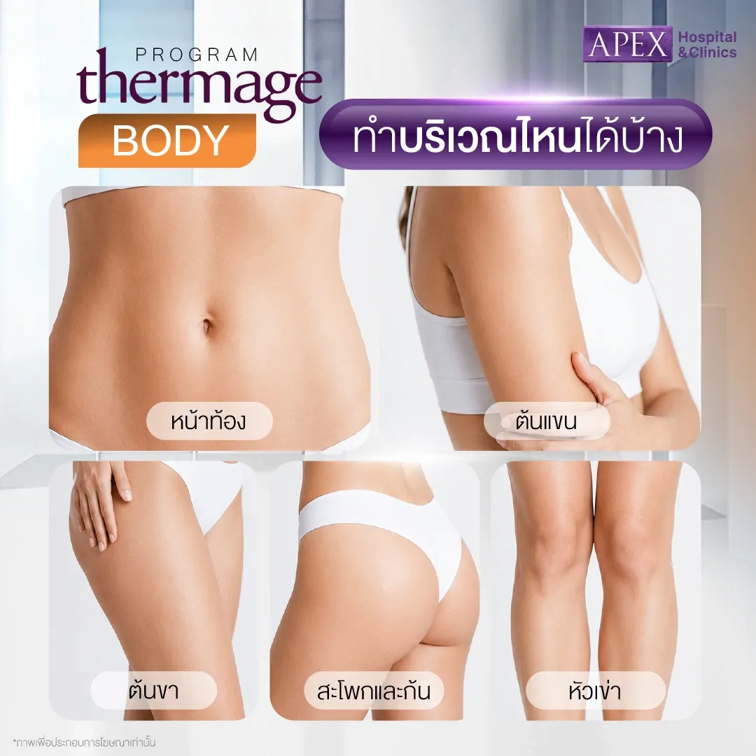 Thermage Body ทำบริเวณไหนได้บ้าง