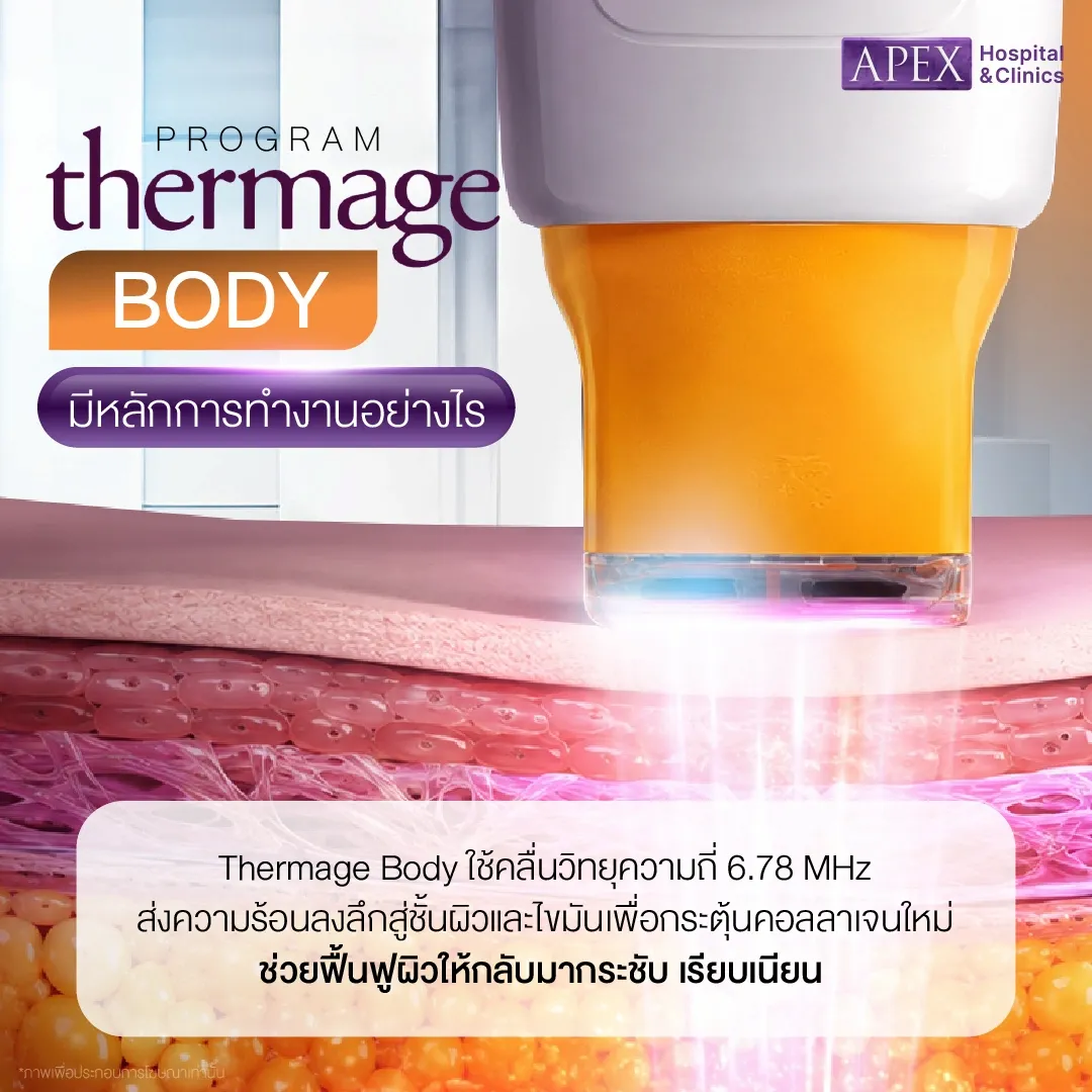 Thermage Body มีหลักการทำงานอย่างไร