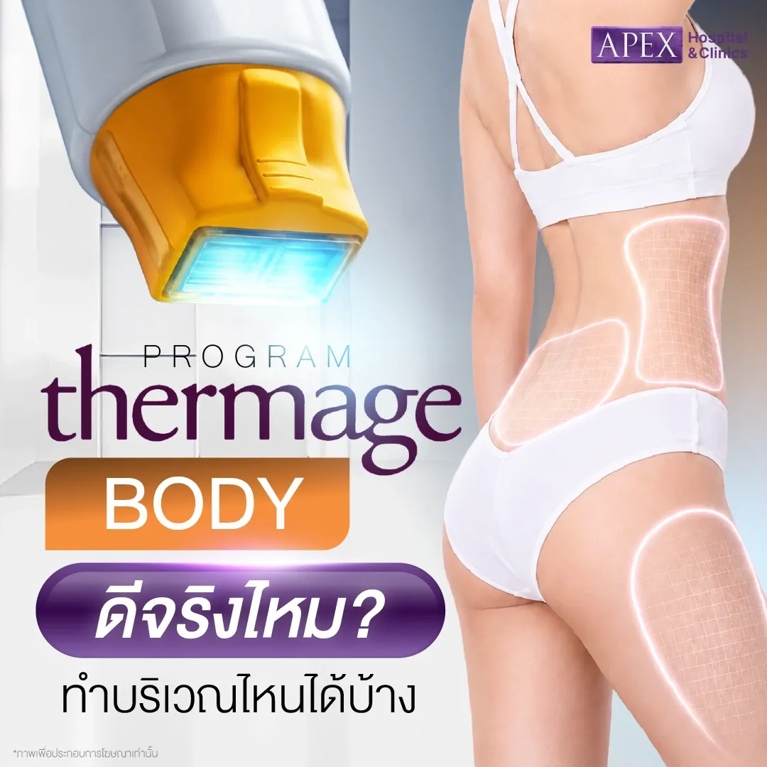 Thermage Body