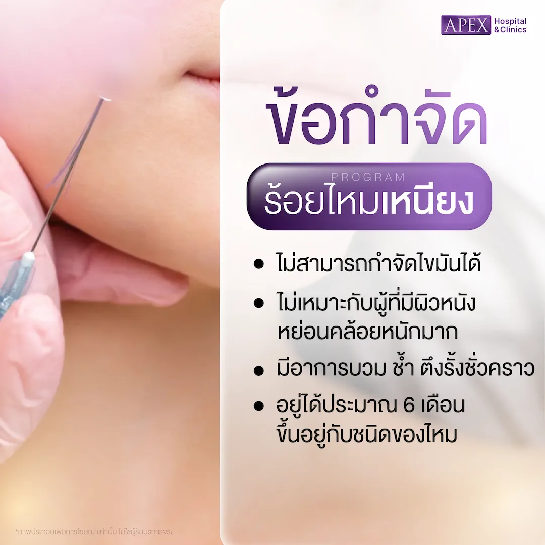 ข้อจำกัดของการร้อยไหมเหนียง