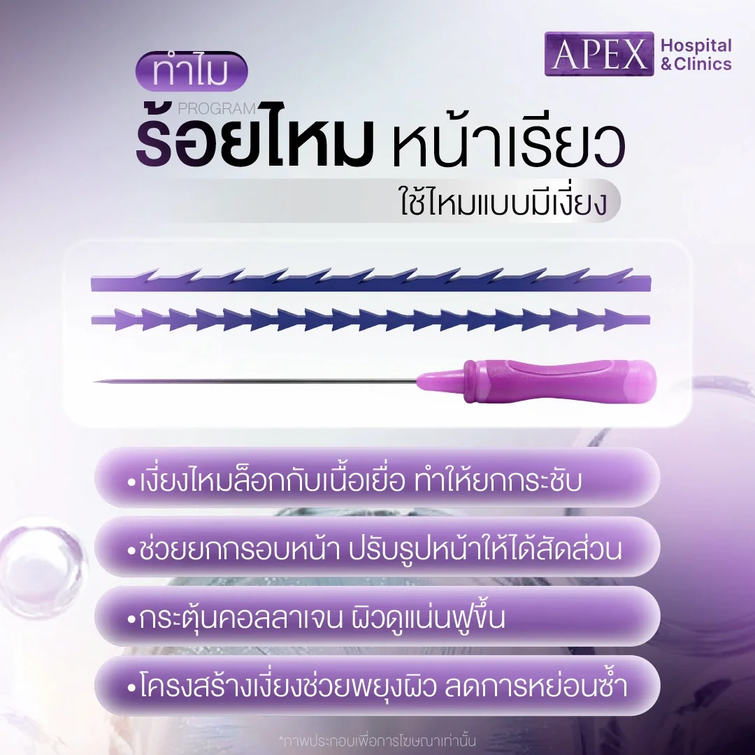 ทำไมการร้อยไหมหน้าเรียว ใช้ไหมแบบมีเงี่ยง