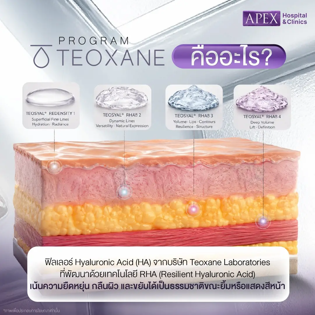 ฟิลเลอร์ Teoxane คืออะไร