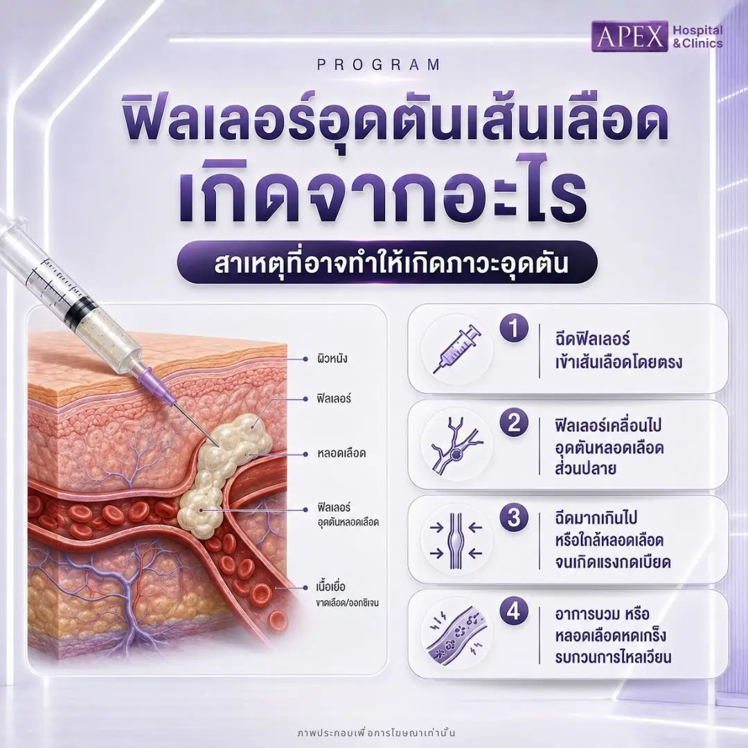 ฟิลเลอร์อุดตันเส้นเลือด เกิดจากอะไร