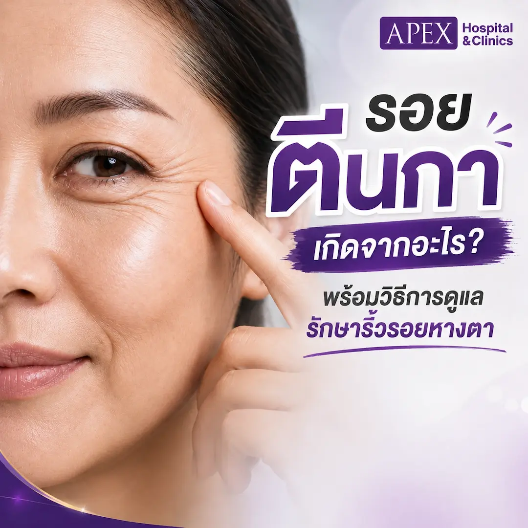 รอยตีนกา คืออะไร เกิดจากอะไร