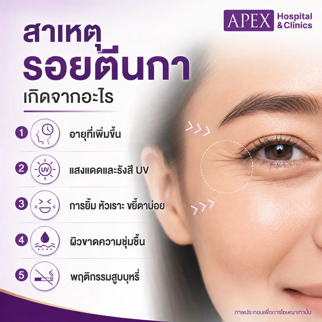 รอยตีนกา สาเหตุเกิดจากอะไร