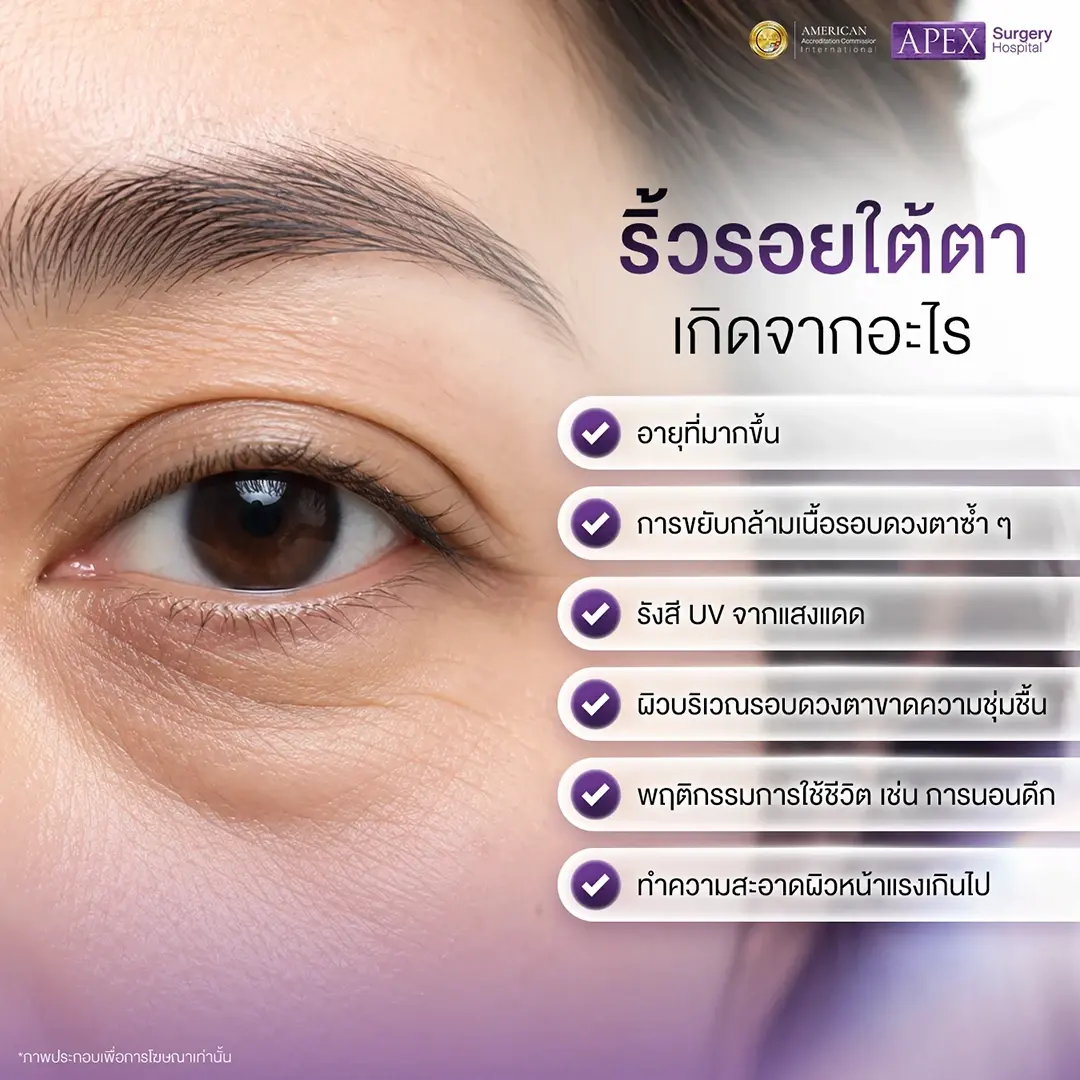 ริ้วรอยใต้ตา เกิดจากอะไร