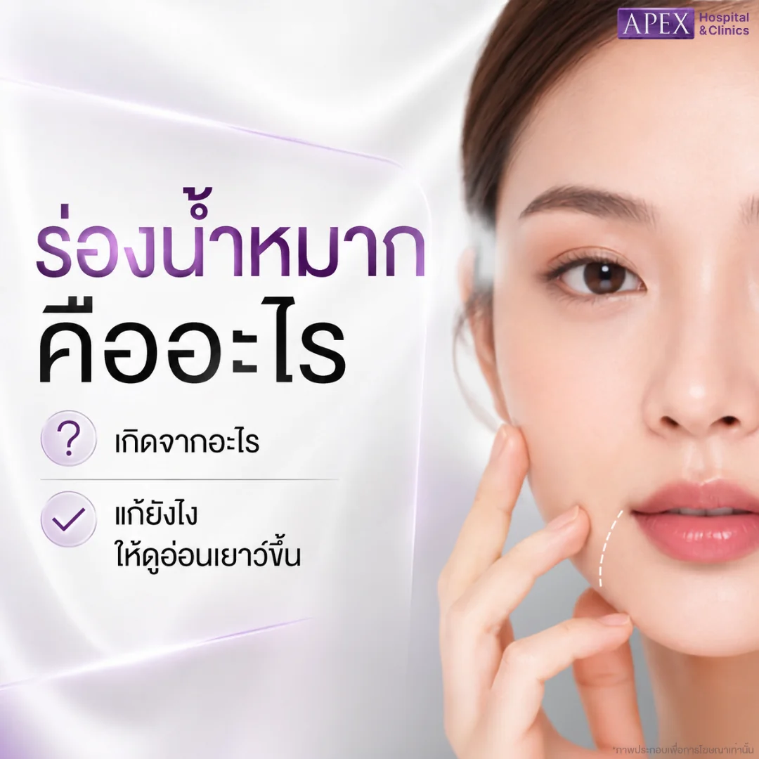 ร่องน้ำหมาก
