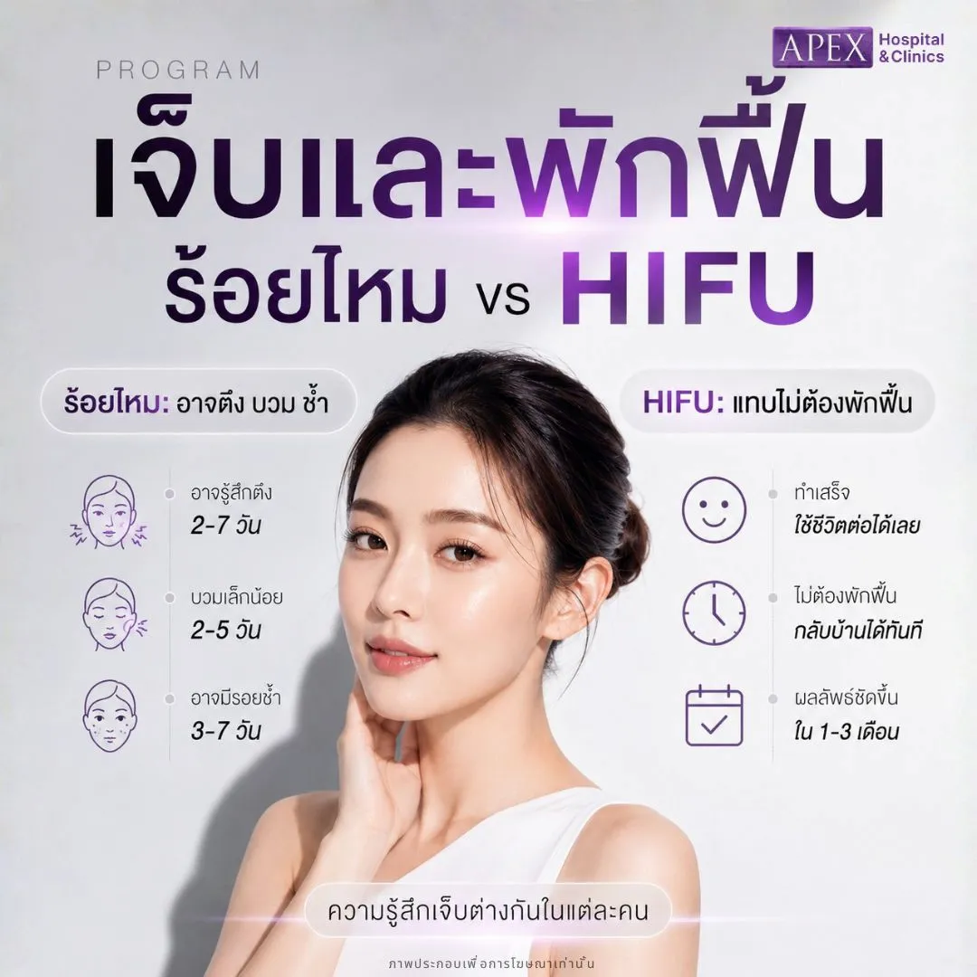 ร้อยไหม vs HIFU แบบไหนเจ็บกว่าและฟื้นตัวต่างกันอย่างไร