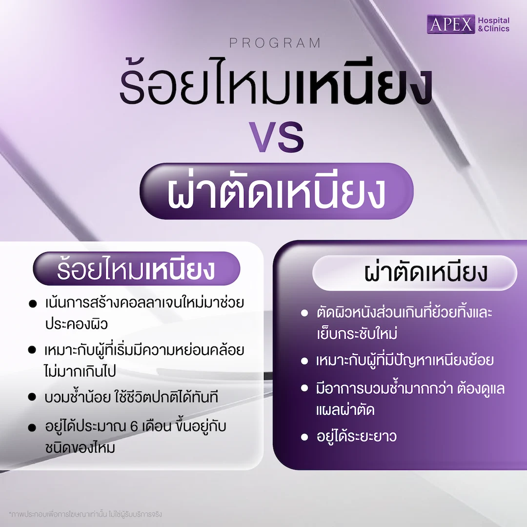 ร้อยไหมเหนียง กับผ่าตัดเหนียง
