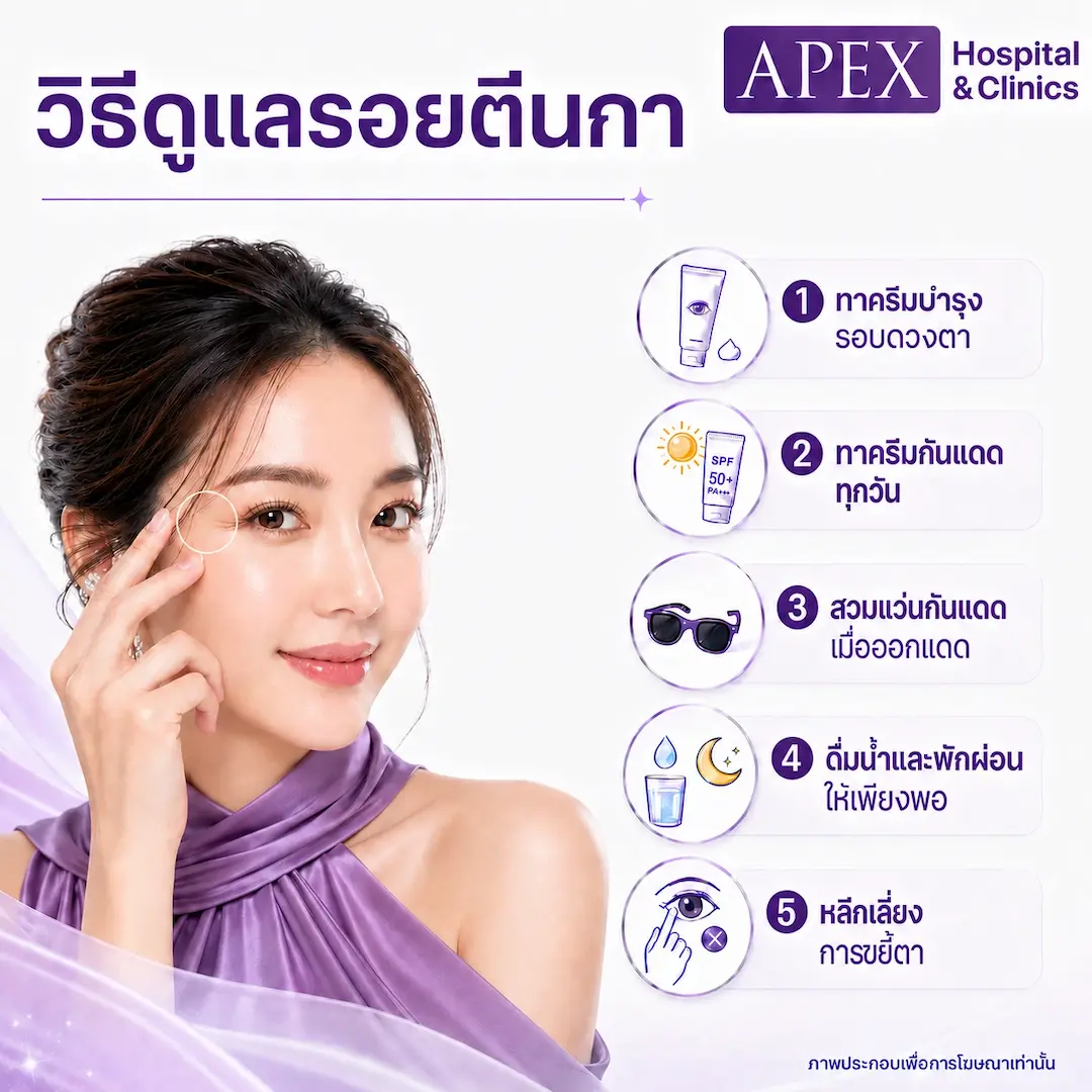 วิธีดูแลรอยตีนกาด้วยตัวเอง