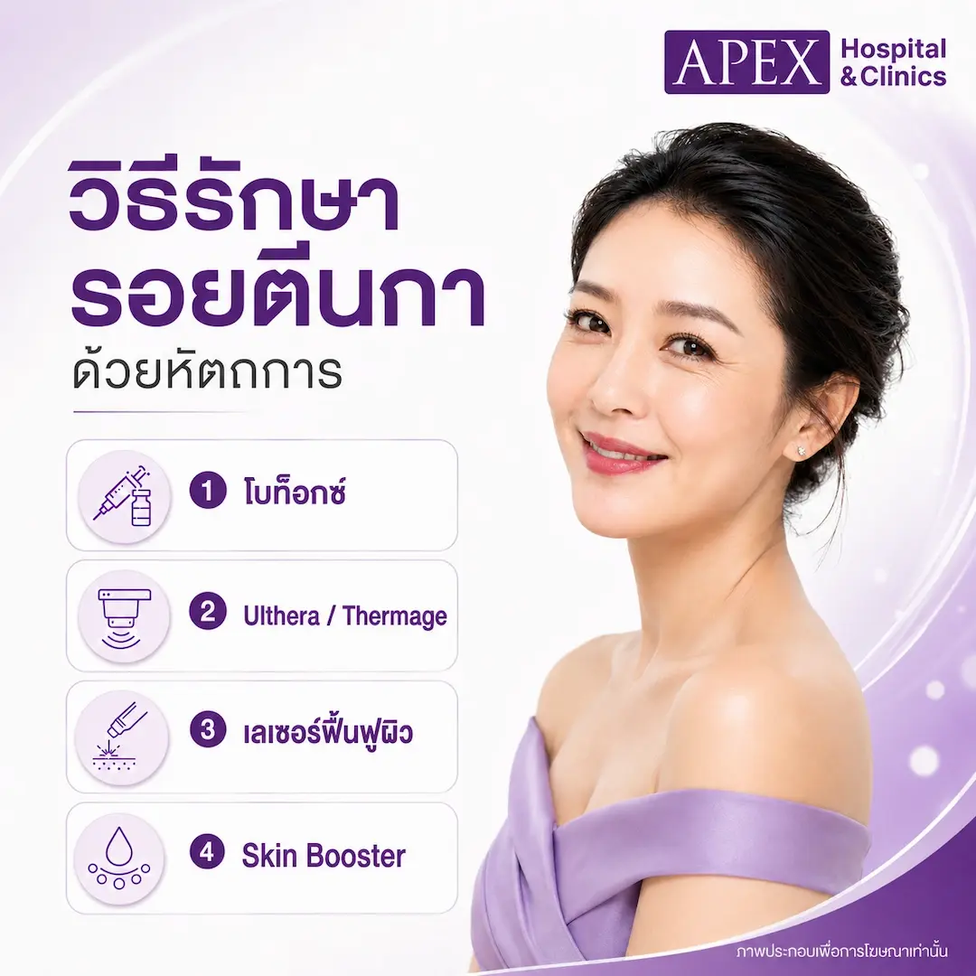 วิธีรักษารอยตีนกาด้วยหัตถการ