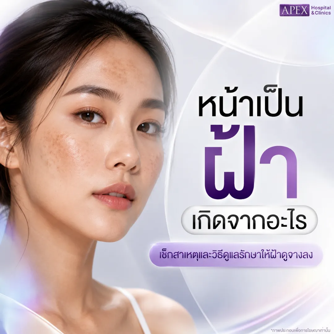 หน้าเป็นฝ้า