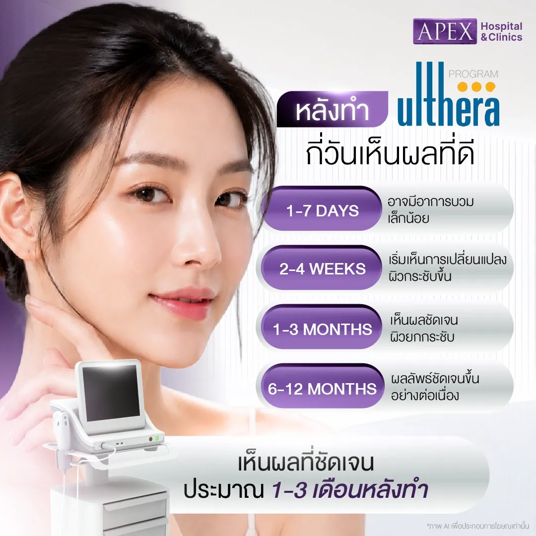 หลังทำ Ulthera กี่วันเห็นผล