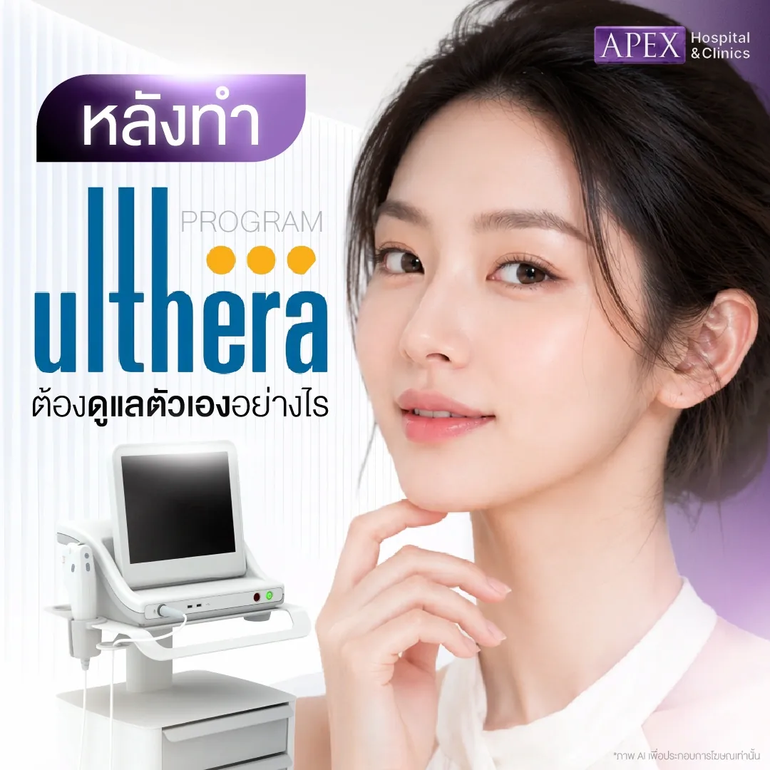 หลังทำ Ulthera