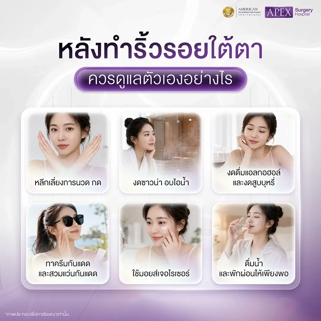 หลังทำหัตถการลดริ้วรอยใต้ตา ควรดูแลตัวเองอย่างไร