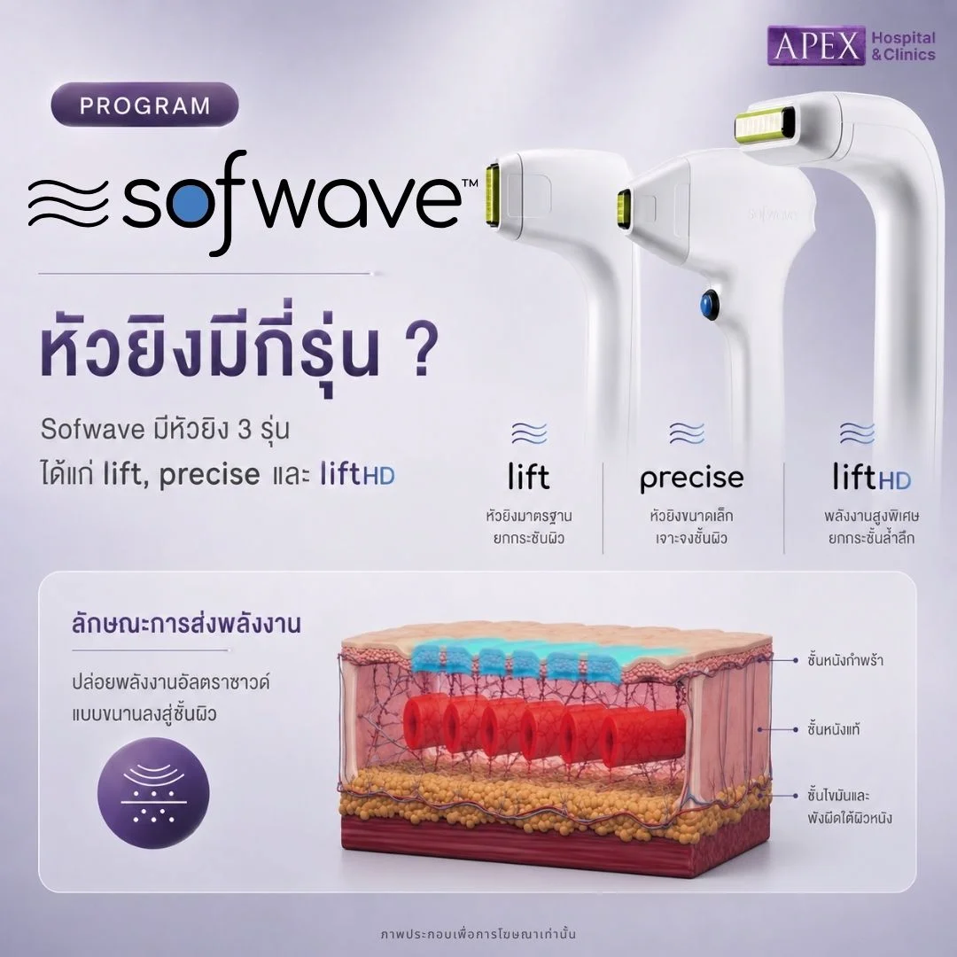 หัวยิงของ Sofwave มีกี่รุ่น