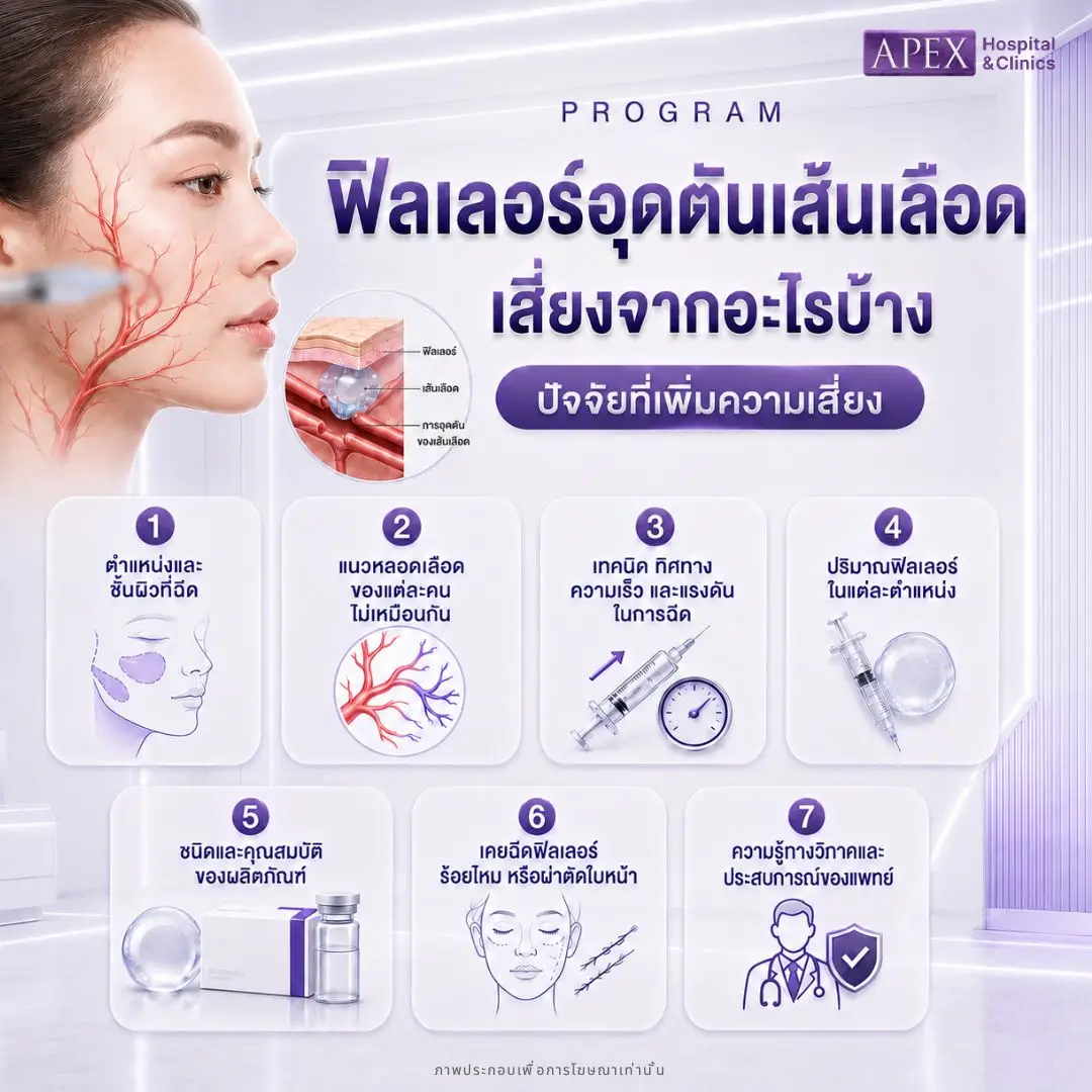 อะไรบ้างที่ทำให้เสี่ยงต่อฟิลเลอร์อุดตันเส้นเลือด