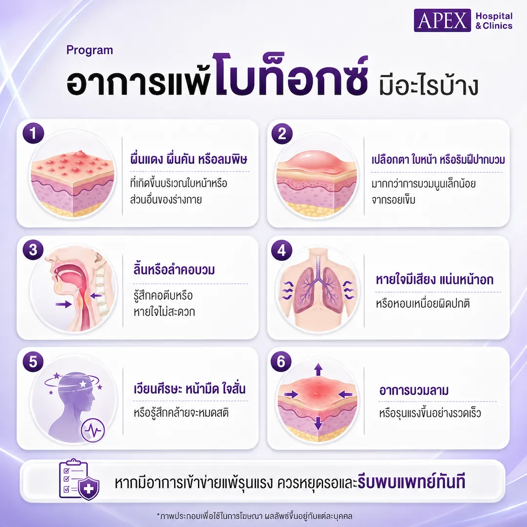 อาการแพ้โบท็อกซ์ มีอาการแบบไหนบ้าง