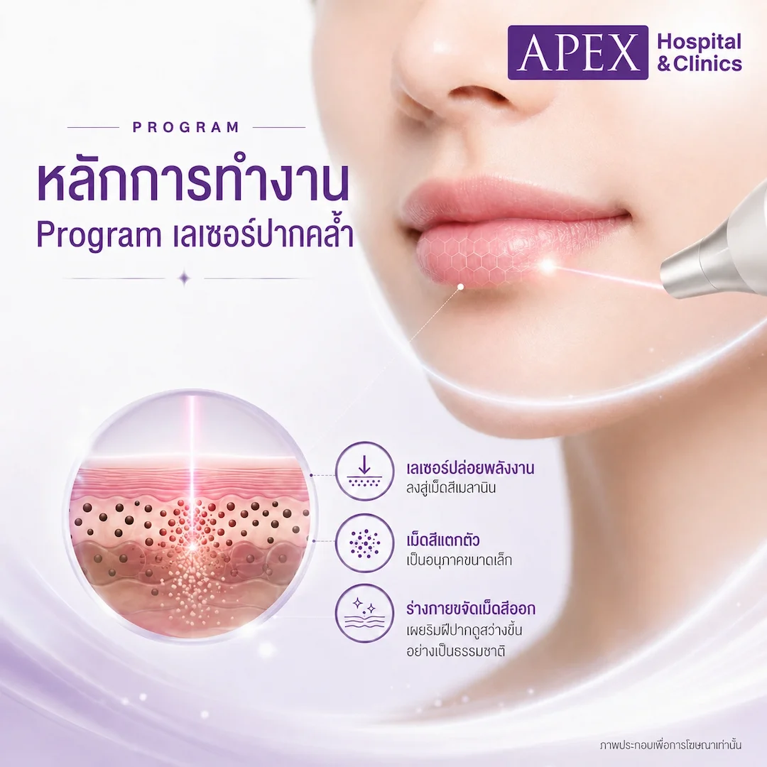 เลเซอร์ปากคล้ำ มีกลไลการทำงานอย่างไร