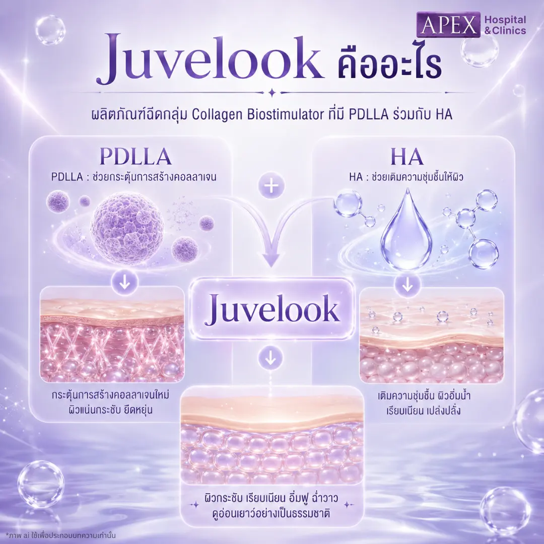 Juvelook คืออะไร