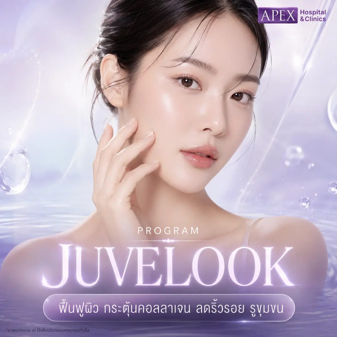Juvelook