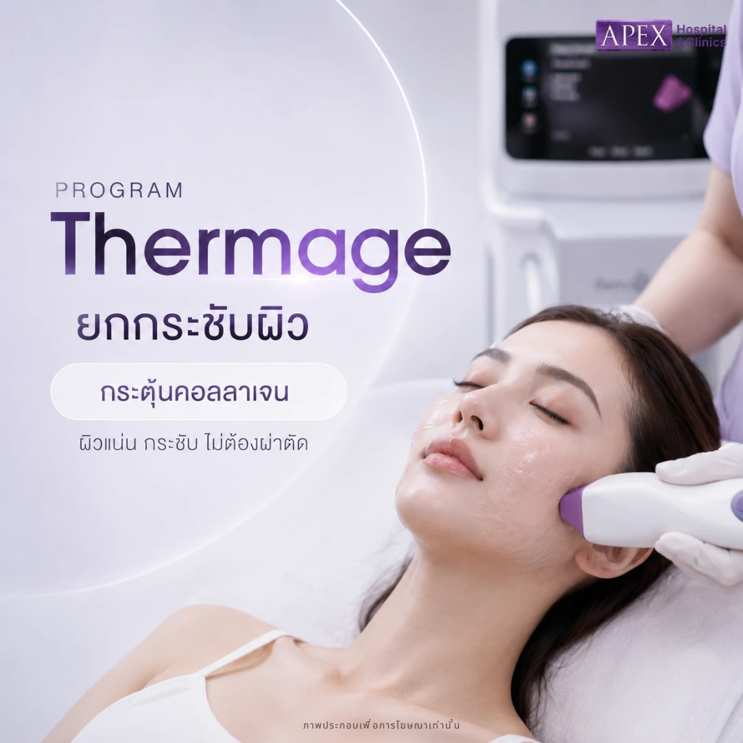 Thermage